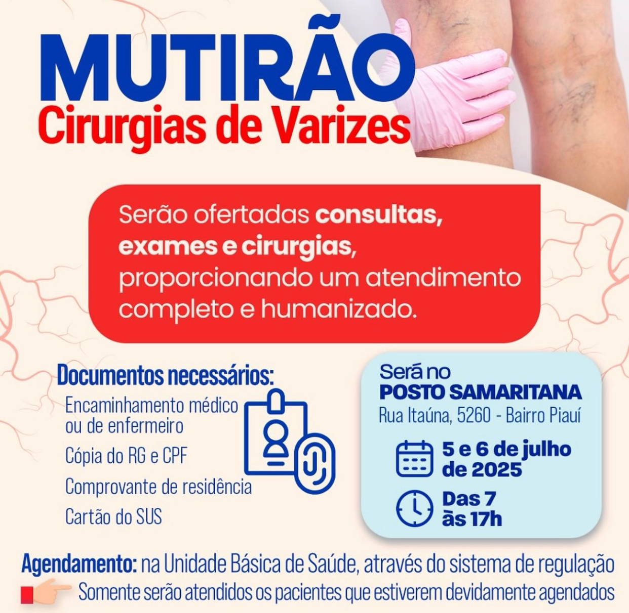 Por determinação do prefeito Francisco Emanuel, Prefeitura de Parnaíba realiza Mutirão de Varizes que beneficia centenas de parnaibanos